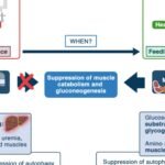 Nutrition Plan For Intensive Care Patients
